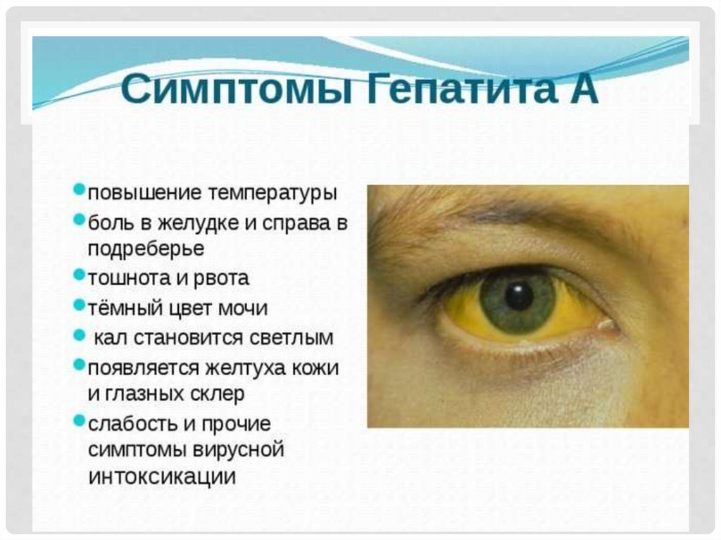 Вирусный гепатит А