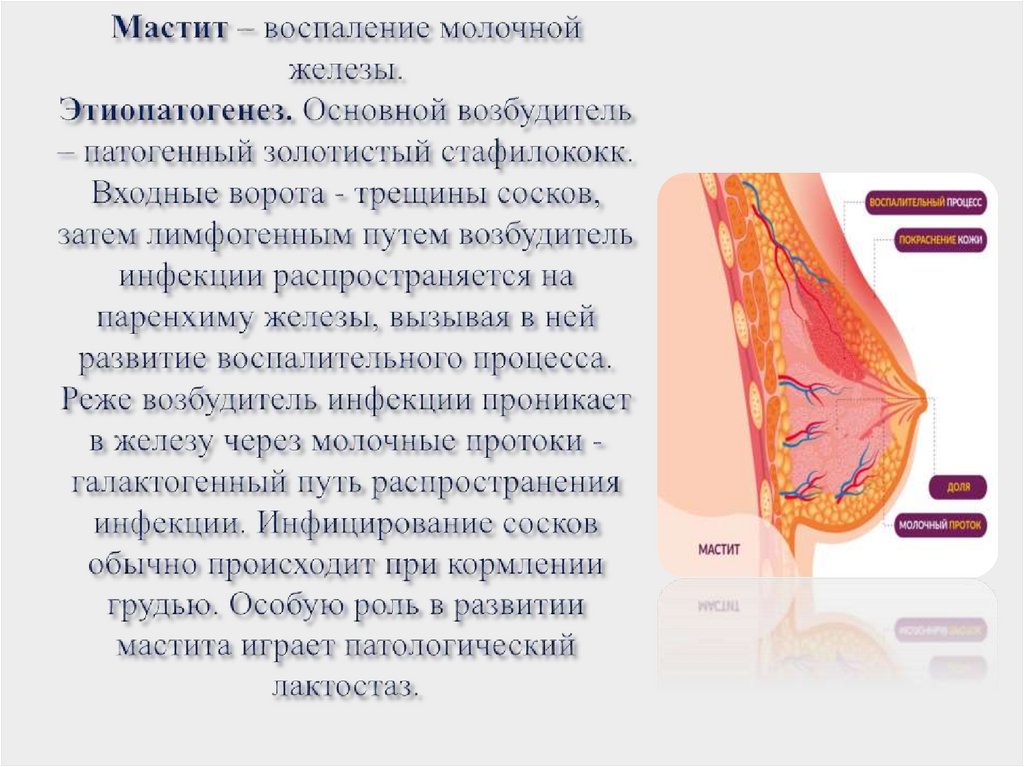 Мастит – воспаление молочной железы. Этиопатогенез. Основной возбудитель – патогенный золотистый стафилококк. Входные ворота -