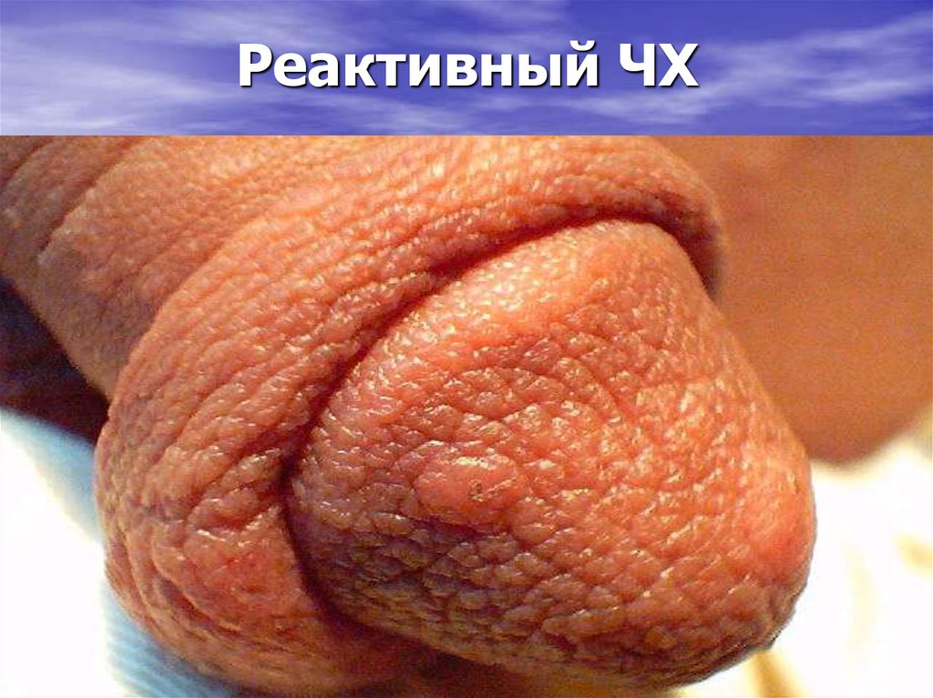 Реактивный ЧХ