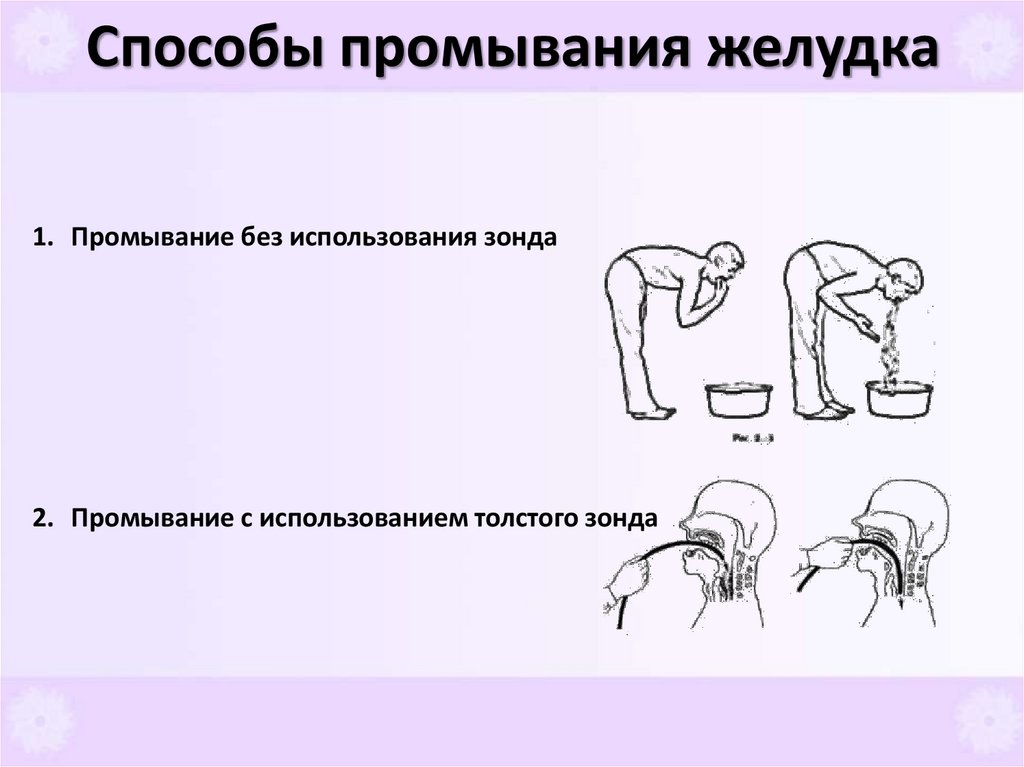 Способы промывания желудка