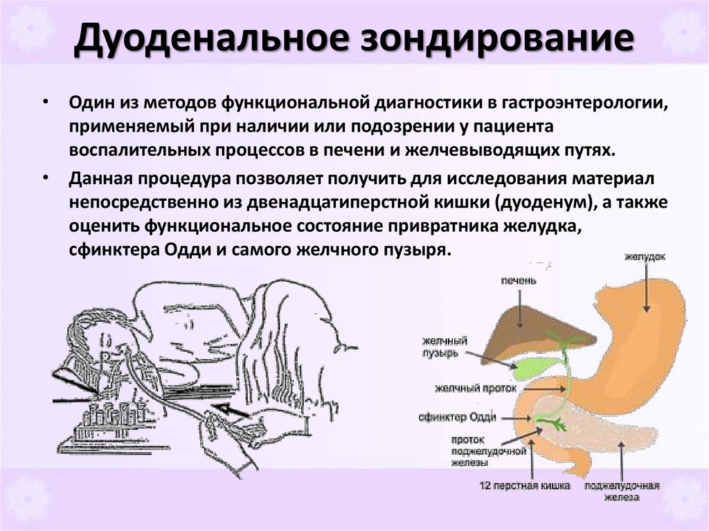 Дуоденальное зондирование