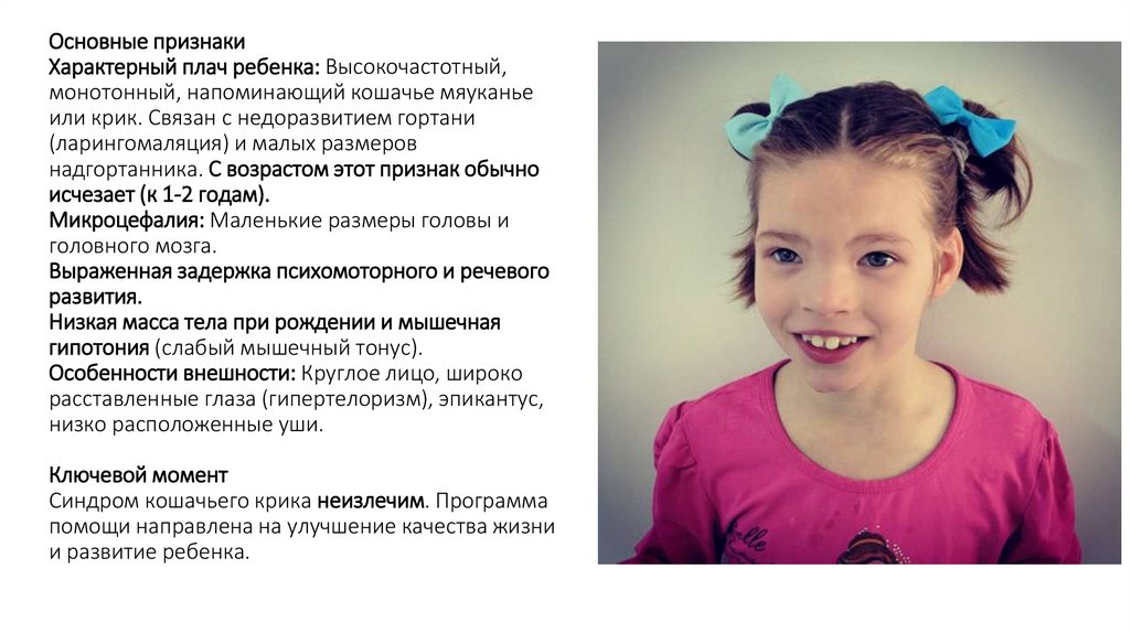 Основные признаки Характерный плач ребенка: Высокочастотный, монотонный, напоминающий кошачье мяуканье или крик. Связан с