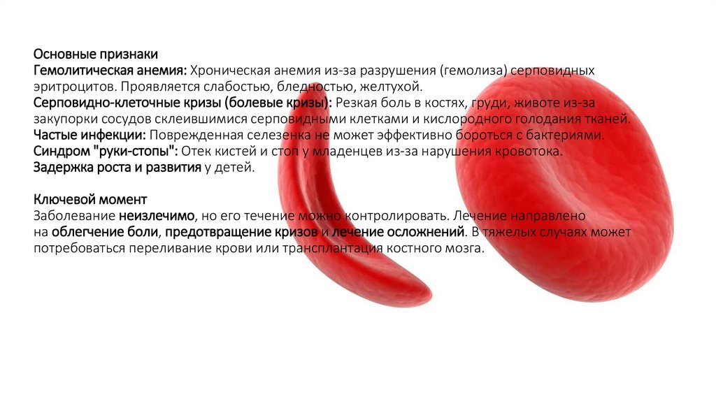 Основные признаки Гемолитическая анемия: Хроническая анемия из-за разрушения (гемолиза) серповидных эритроцитов. Проявляется
