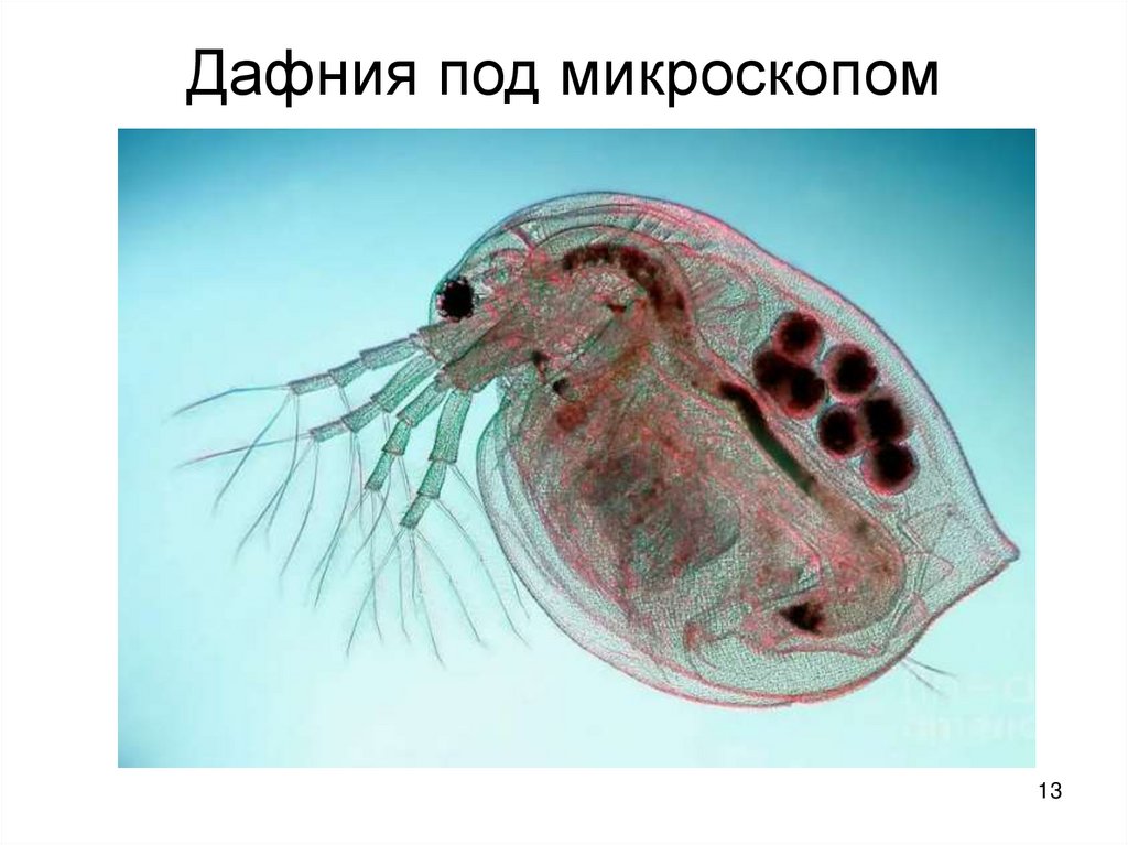 Дафния под микроскопом