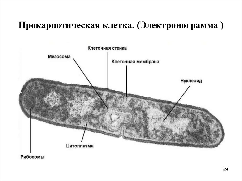 Прокариотическая клетка. (Электронограмма )