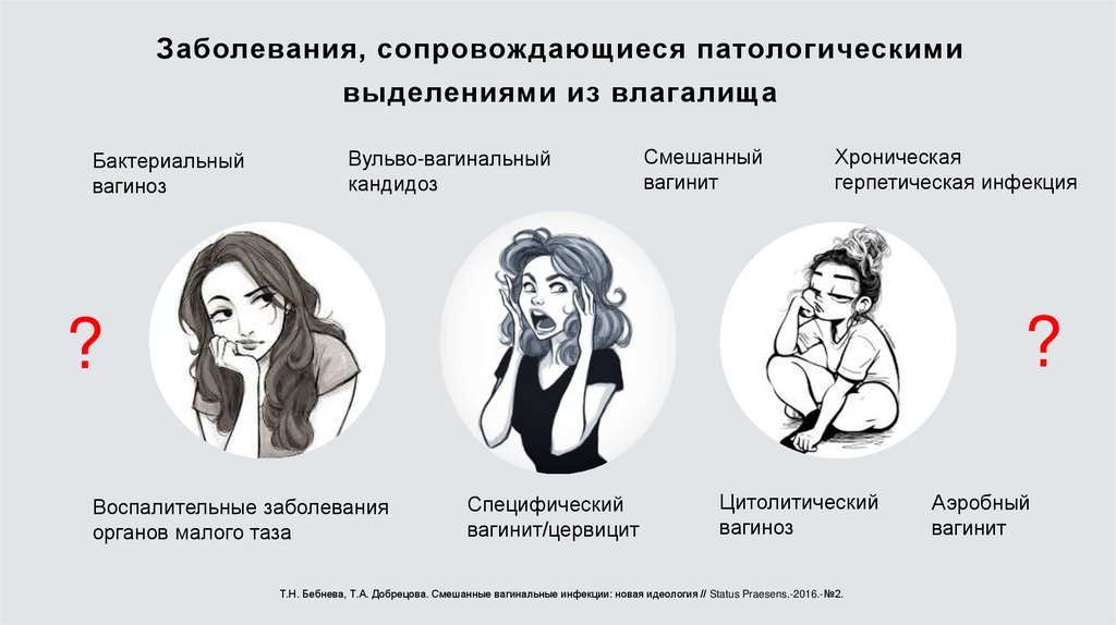 Заболевания, сопровождающиеся патологическими выделениями из влагалища
