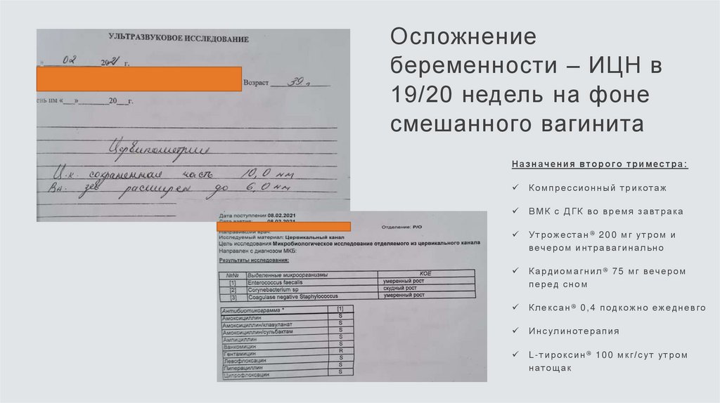 Осложнение беременности – ИЦН в 19/20 недель на фоне смешанного вагинита