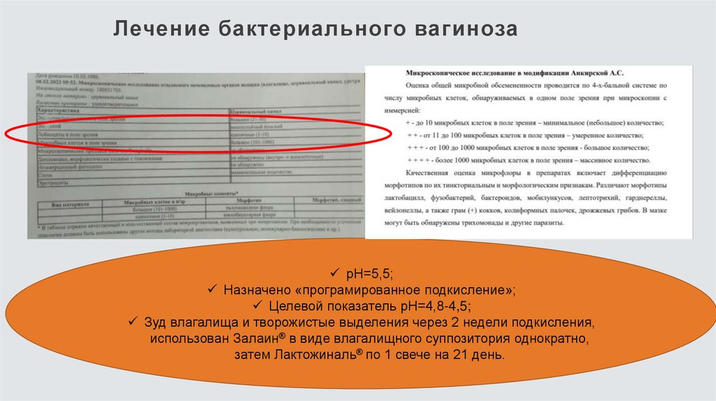 Лечение бактериального вагиноза