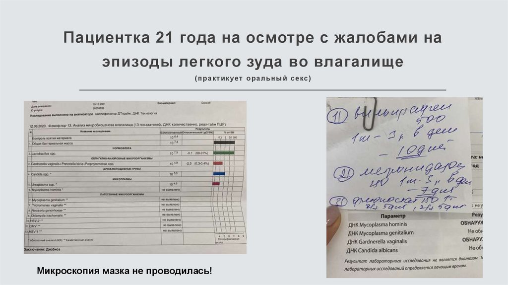Пациентка 21 года на осмотре с жалобами на эпизоды легкого зуда во влагалище (практикует оральный секс)