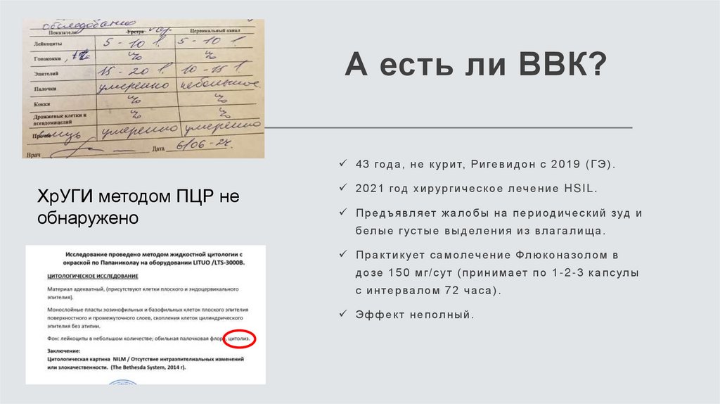 А есть ли ВВК?