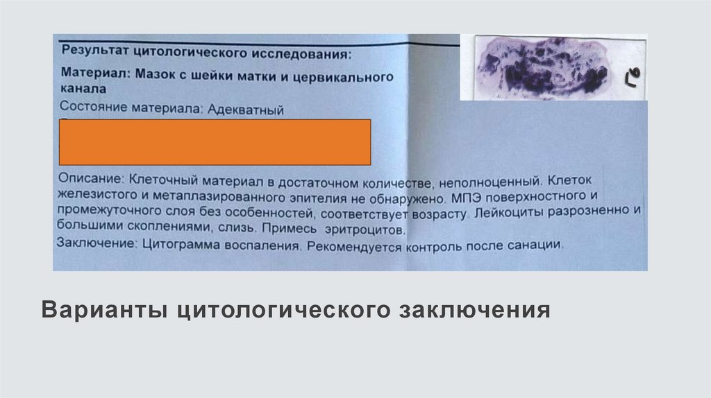 Варианты цитологического заключения