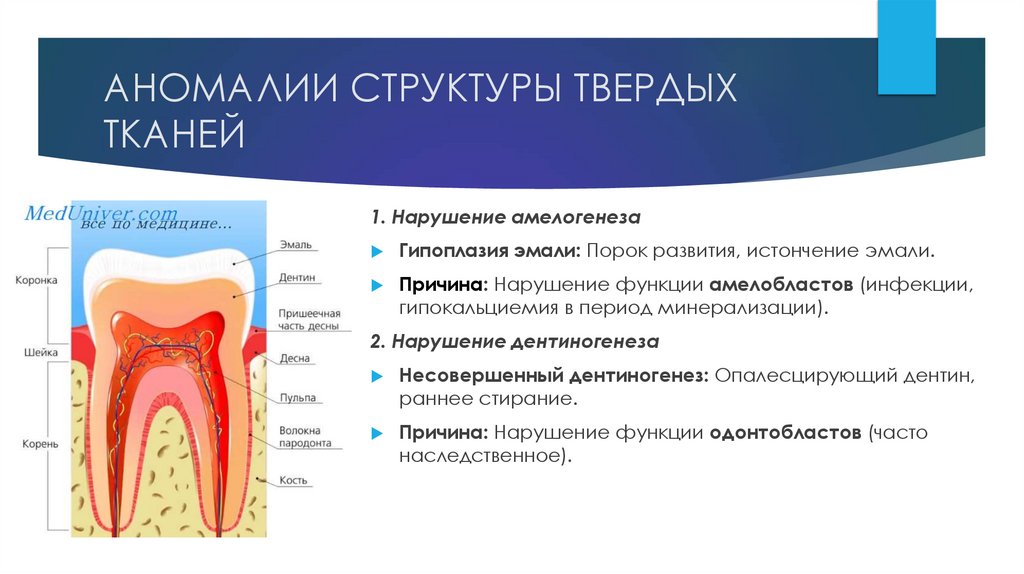 АНОМАЛИИ СТРУКТУРЫ ТВЕРДЫХ ТКАНЕЙ
