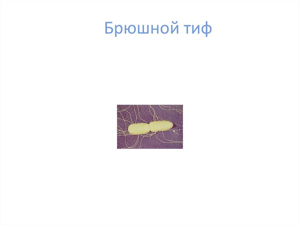 Брюшной тиф