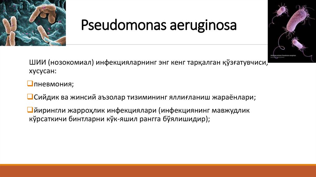 Pseudomonas aeruginosa