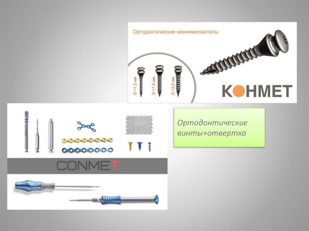 Ортодонтические винты+отвертка