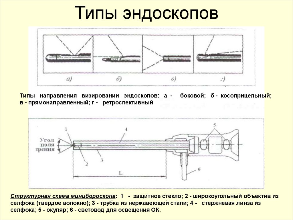 Типы эндоскопов