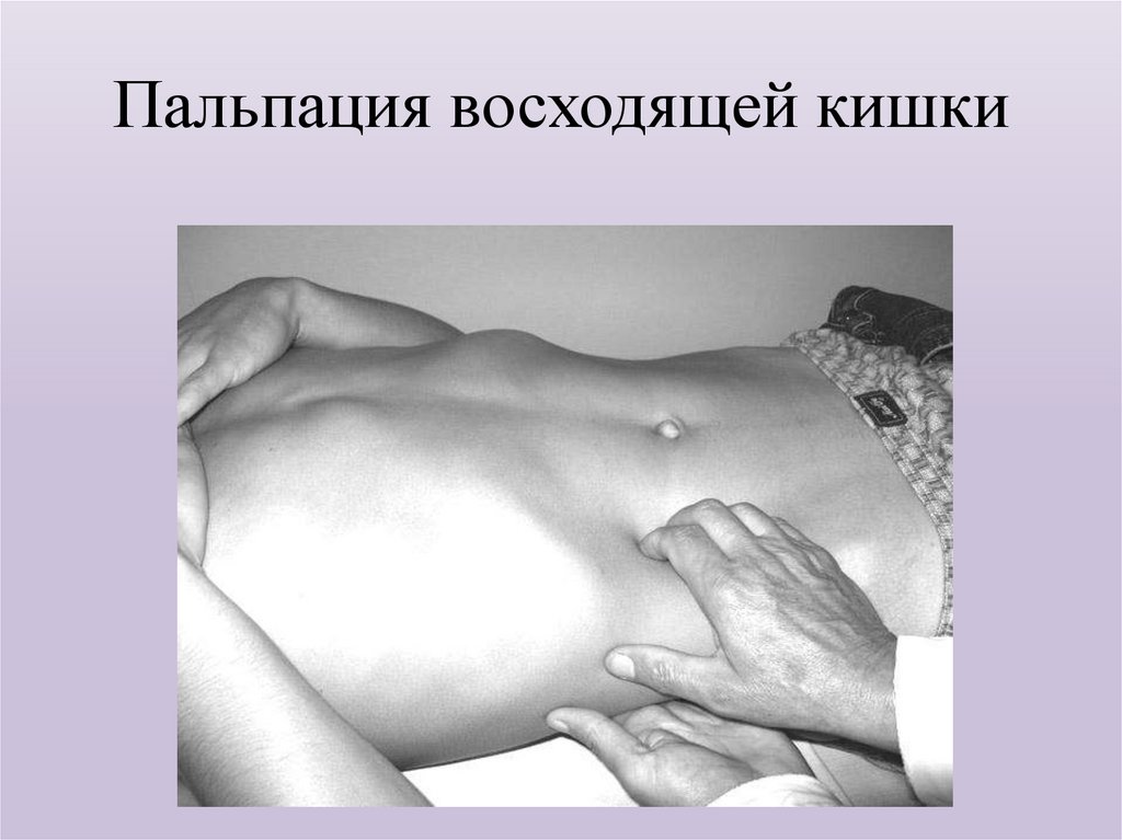Пальпация восходящей кишки