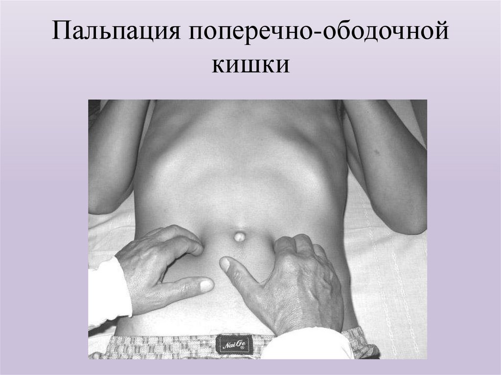 Пальпация поперечно-ободочной кишки