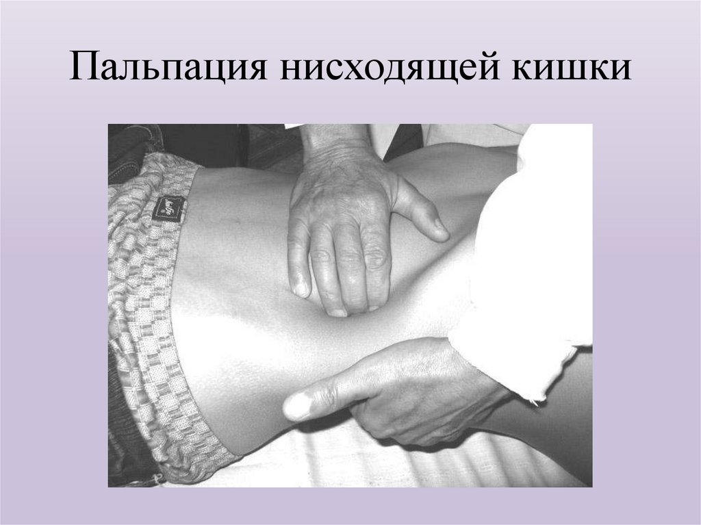 Пальпация нисходящей кишки