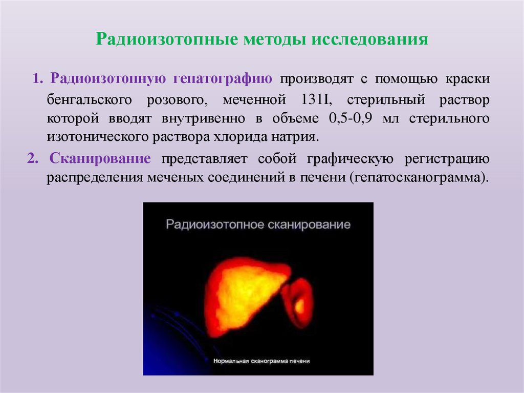 Радиоизотопные методы исследования
