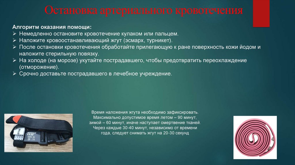 Остановка артериального кровотечения