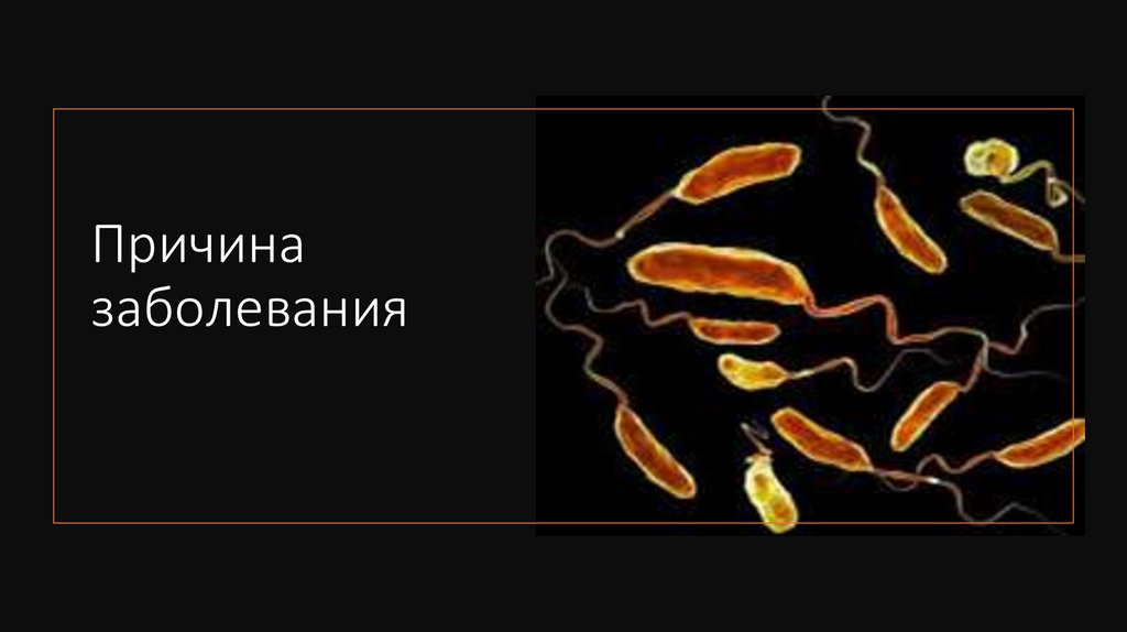 Причина заболевания