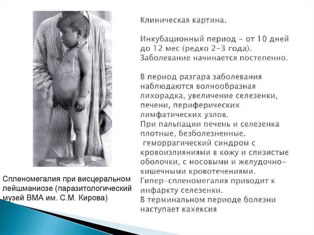 Клиническая картина. Инкубационный период - от 10 дней до 12 мес (редко 2-3 года). Заболевание начинается постепенно. В период