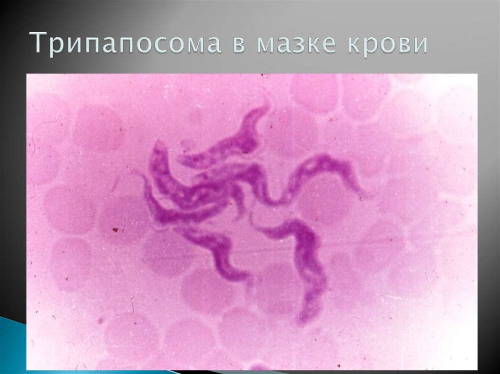 Трипапосома в мазке крови
