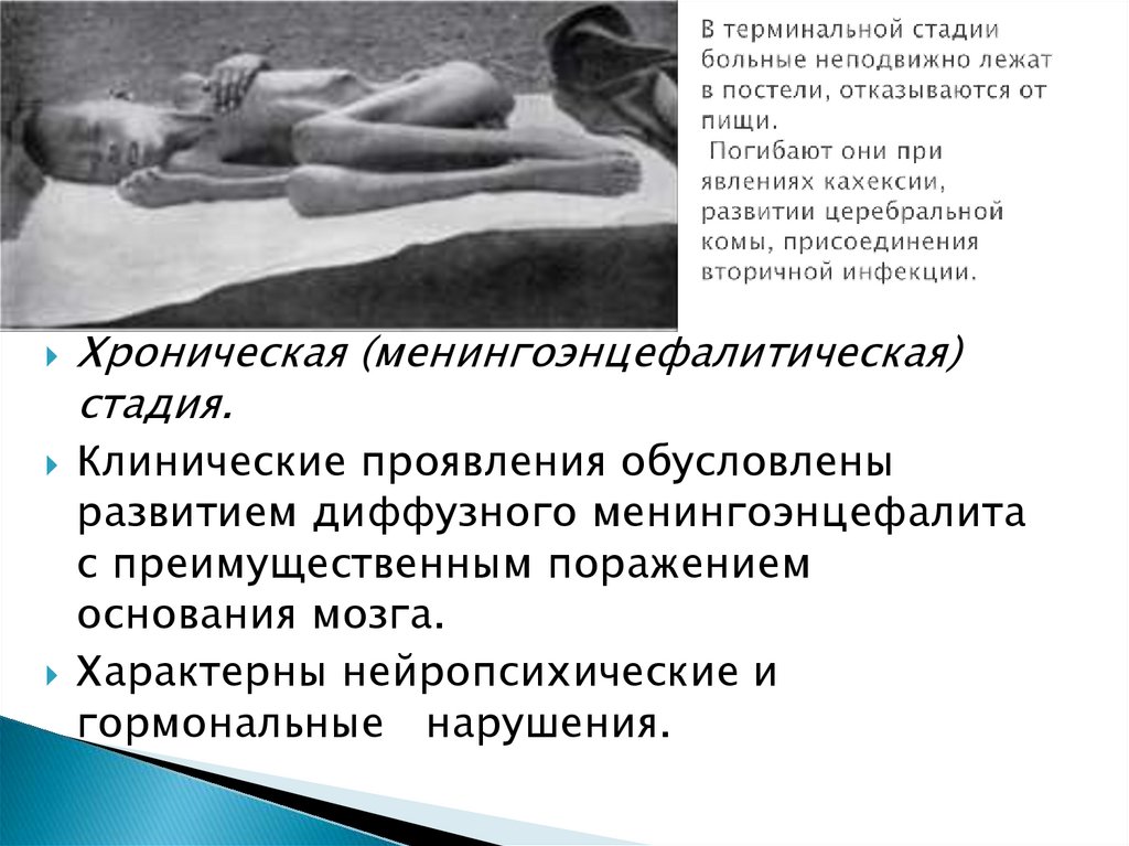 В терминальной стадии больные неподвижно лежат в постели, отказываются от пищи. Погибают они при явлениях кахексии, развитии