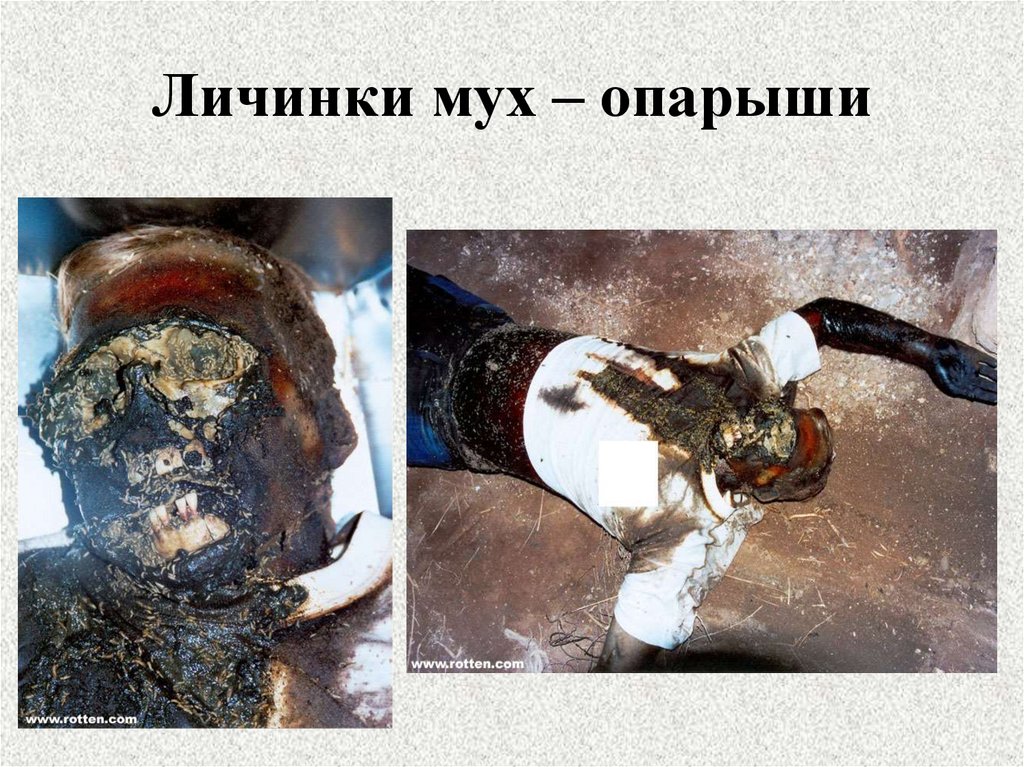 Личинки мух – опарыши