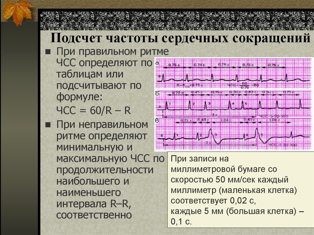 Подсчет частоты сердечных сокращений