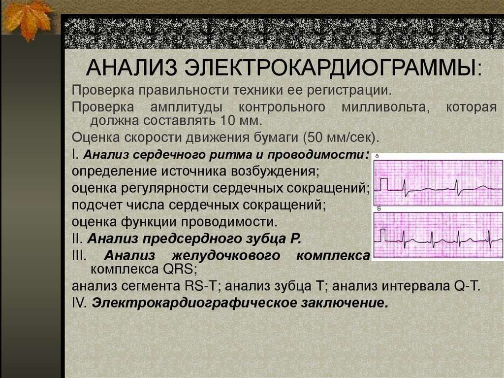 АНАЛИЗ ЭЛЕКТРОКАРДИОГРАММЫ: