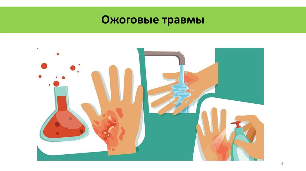 Ожоговые травмы