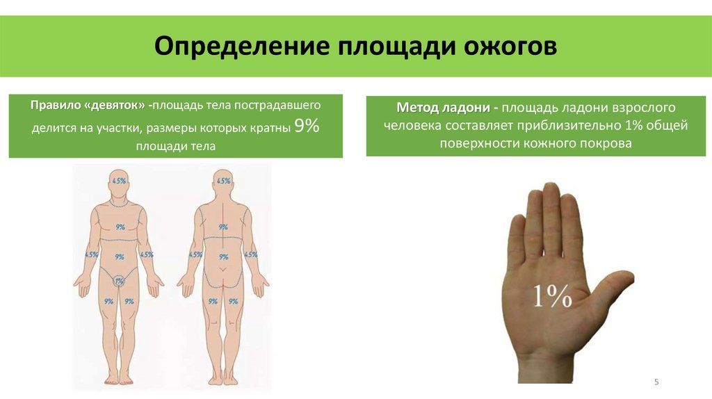 Определение площади ожогов