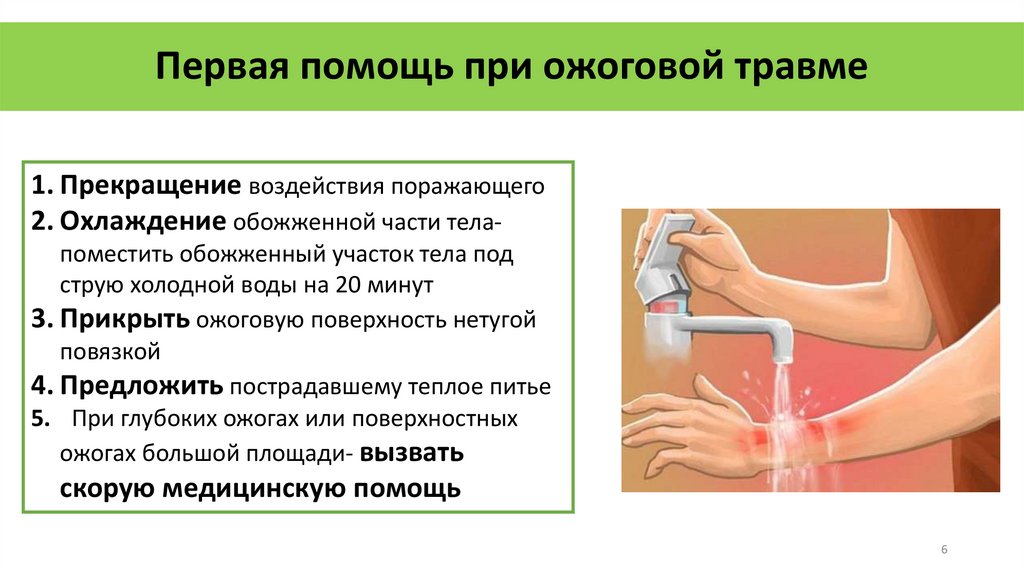 Первая помощь при ожоговой травме