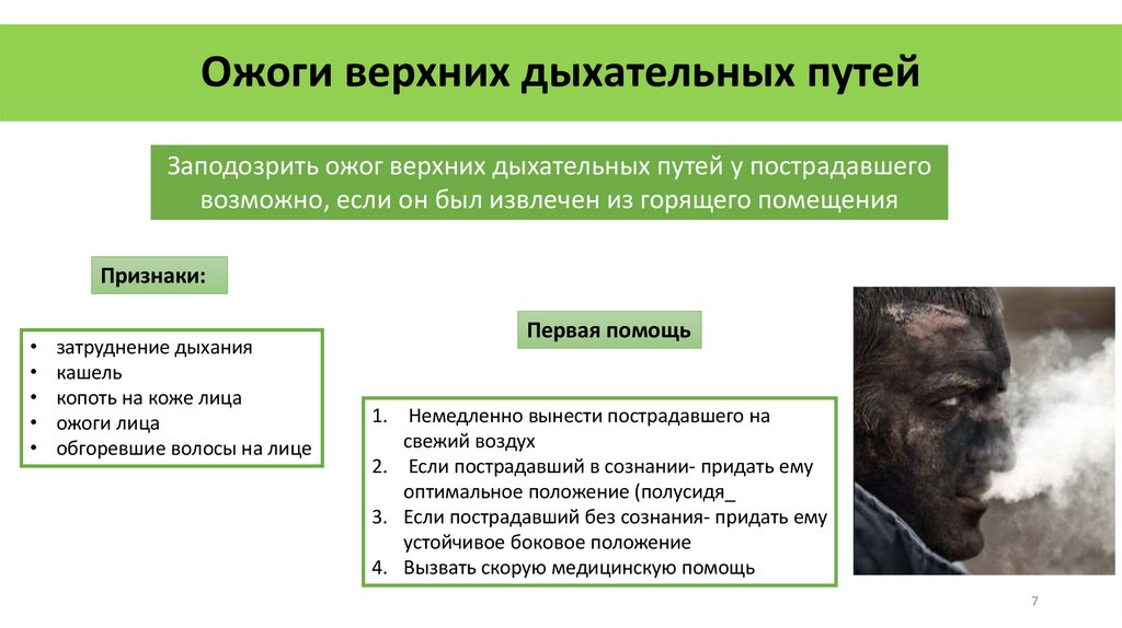 Ожоги верхних дыхательных путей