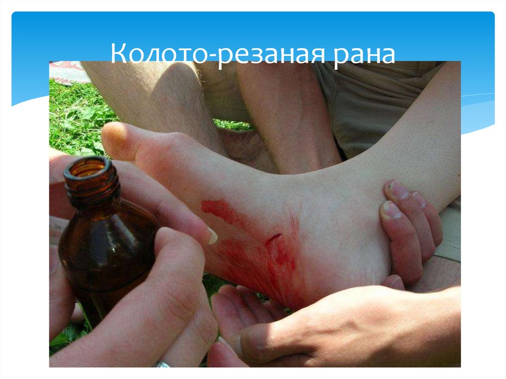 Колото-резаная рана