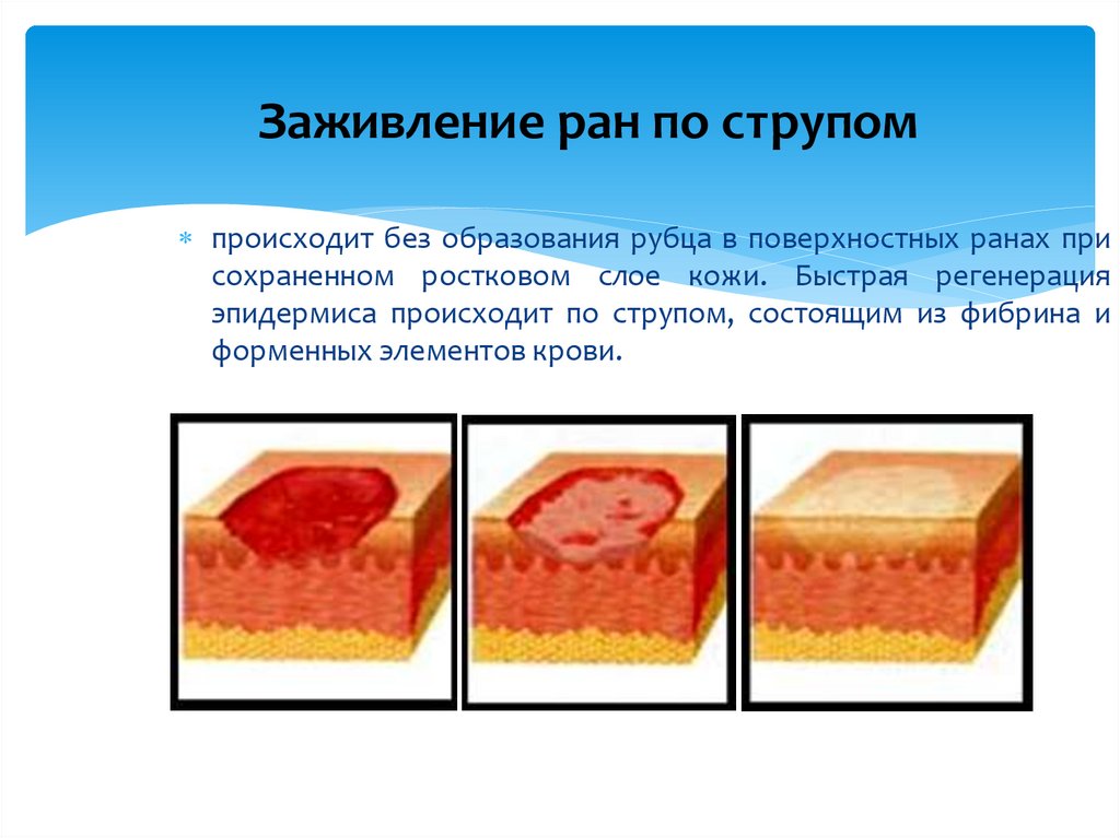 Заживление ран по струпом