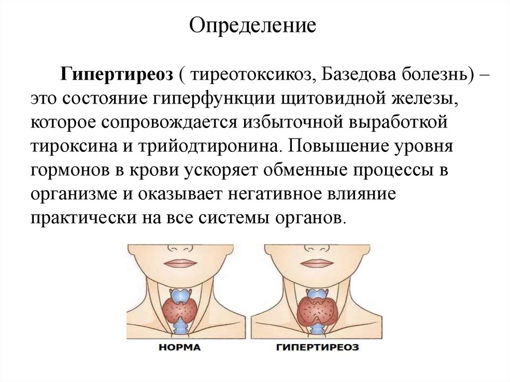 Определение