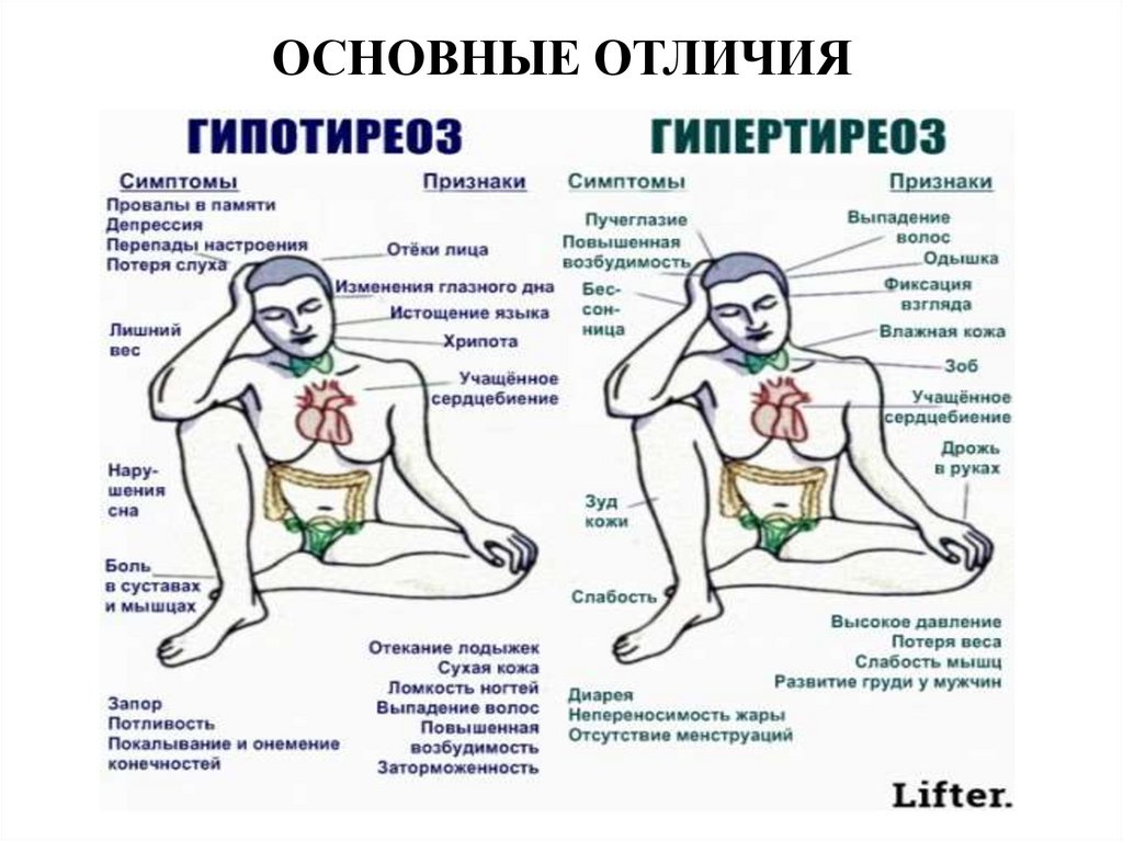 ОСНОВНЫЕ ОТЛИЧИЯ