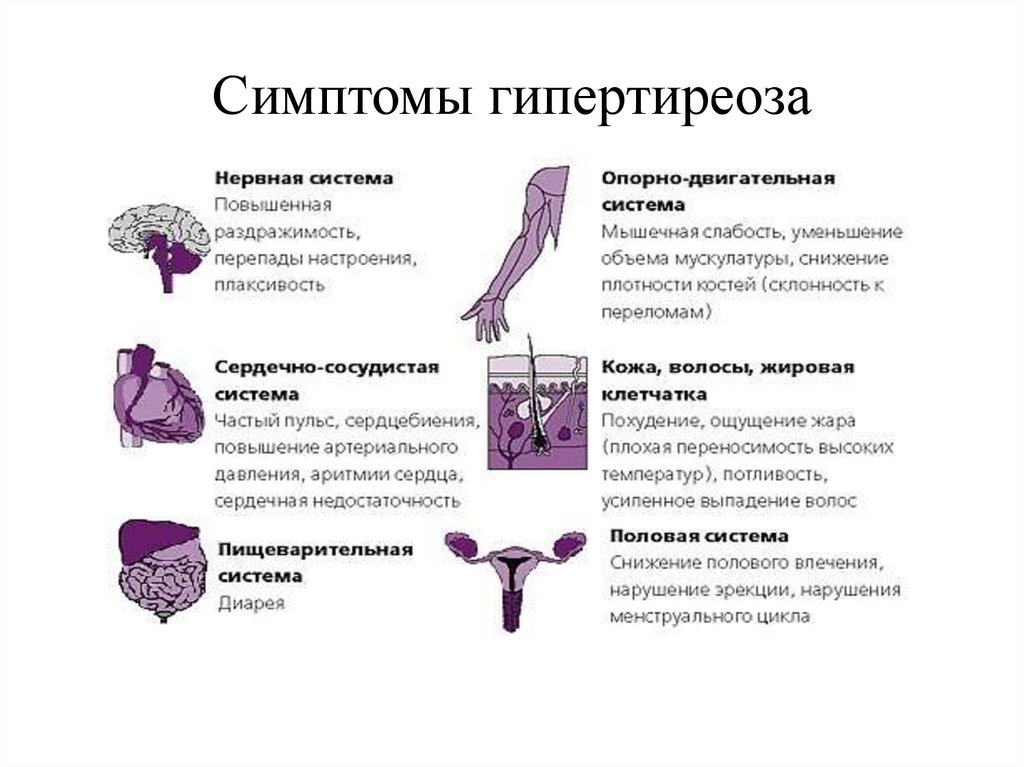 Симптомы гипертиреоза