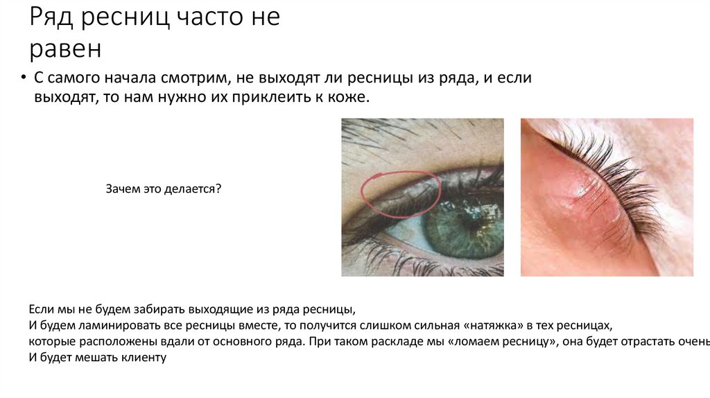 Ряд вій часто не є рівним