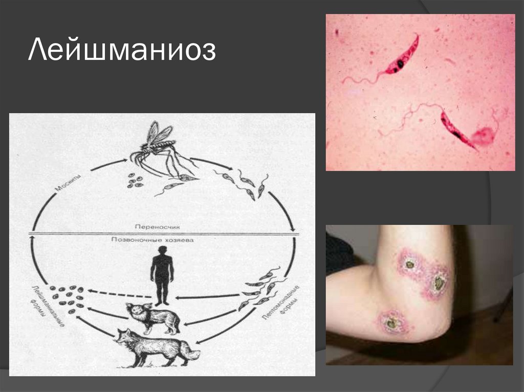 Лейшманиоз