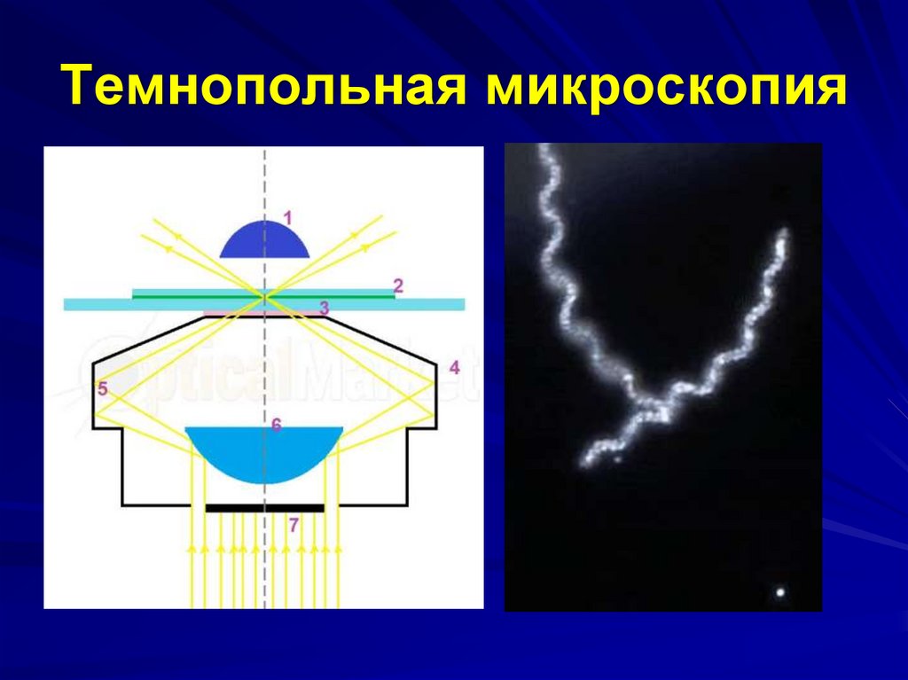 Темнопольная микроскопия