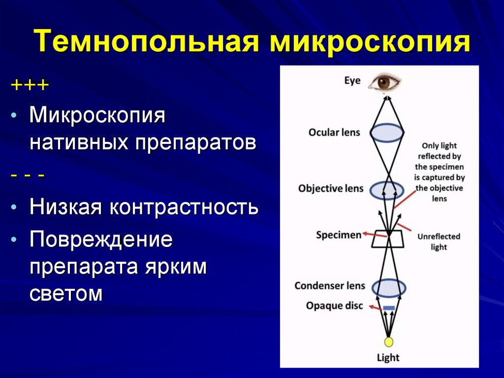 Темнопольная микроскопия