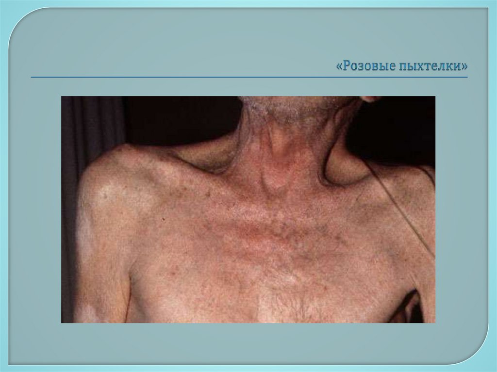 «Розовые пыхтелки»