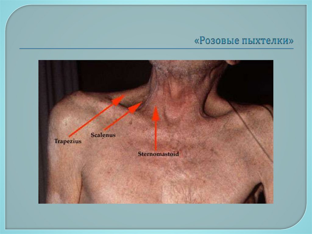 «Розовые пыхтелки»