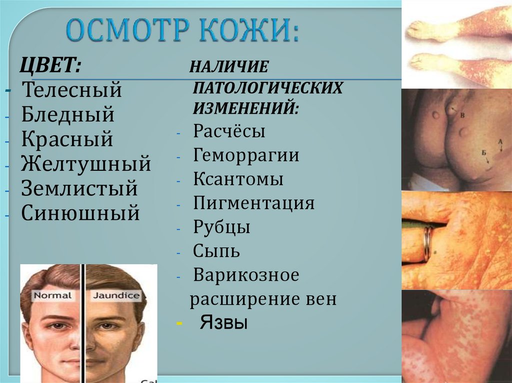 ОСМОТР КОЖИ: