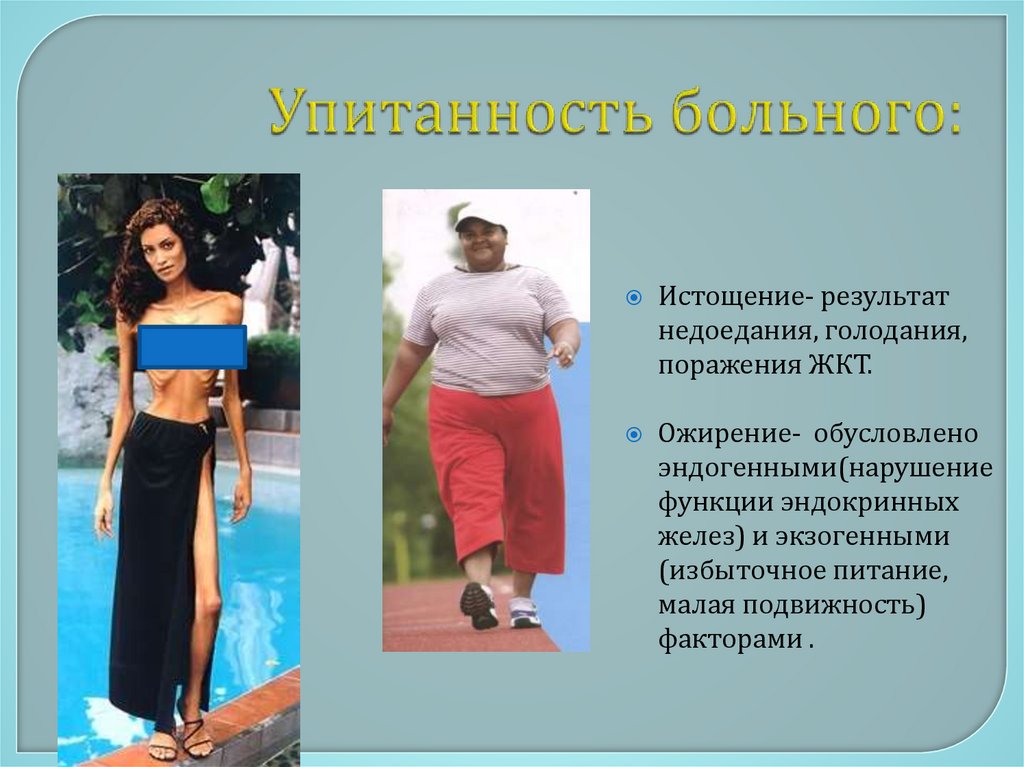 Упитанность больного: