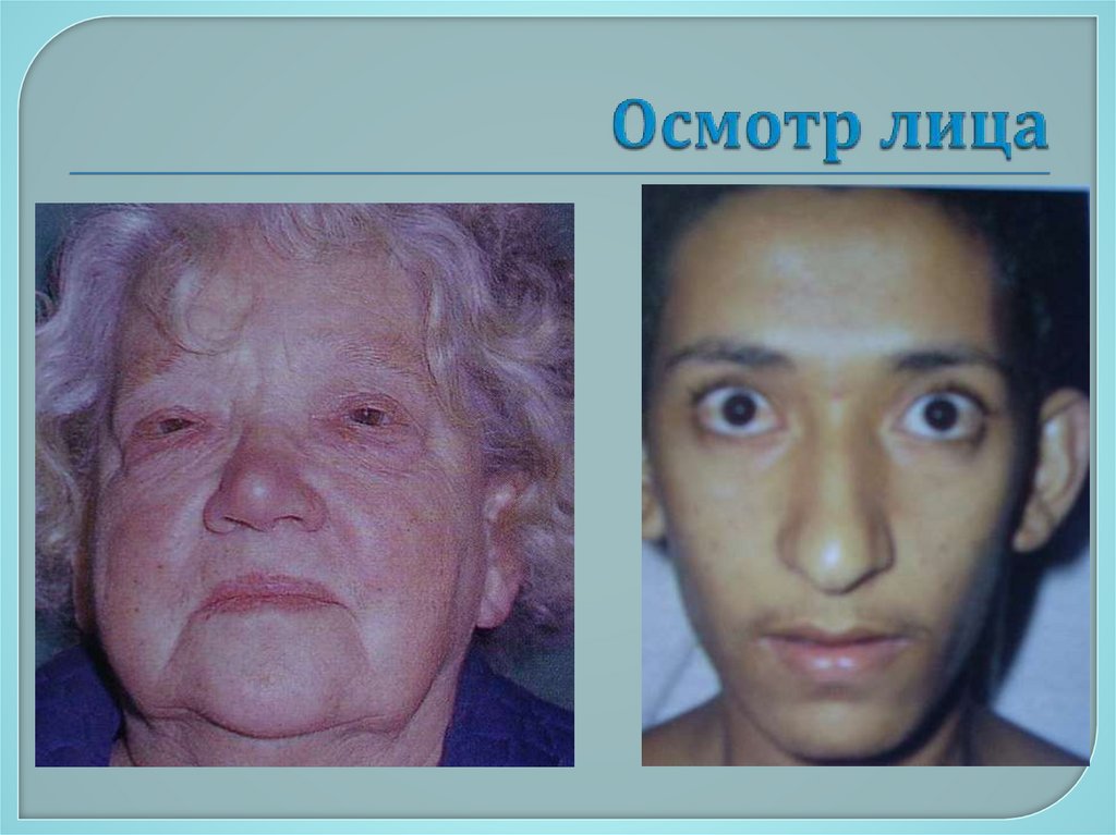 Осмотр лица